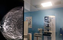 El nuevo sistema de mamografía 3Dimensions con tecnología de tomosíntesis avanzada permite una más cómoda y mejor experiencia para pacientes.